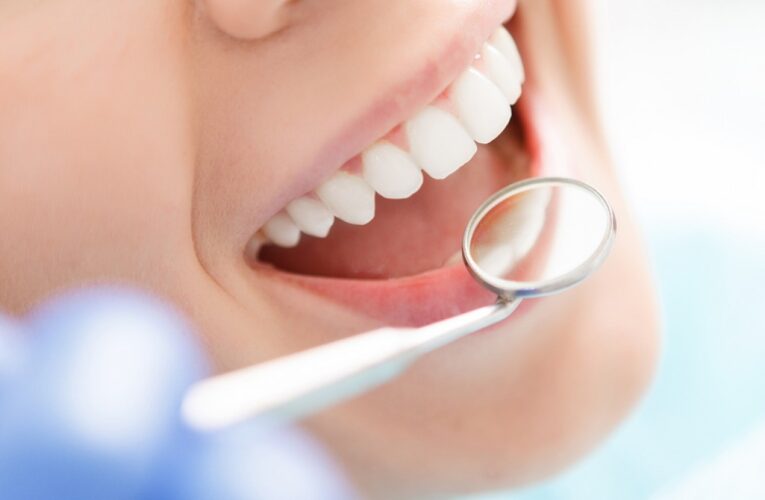 FAQ’s About Root Canal Therapy