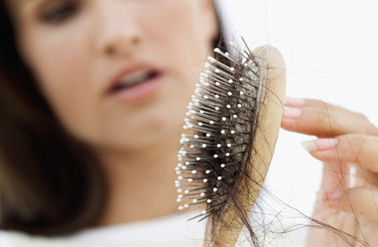 Why is Hair Loss Frequent in Males Than Girls & The way to Forestall