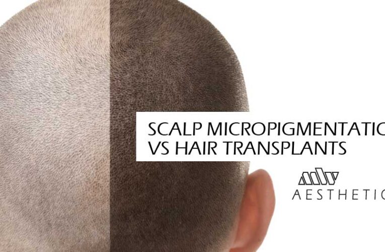 Scalp Micropigmentation – The Best Alternate to Hair Transplant